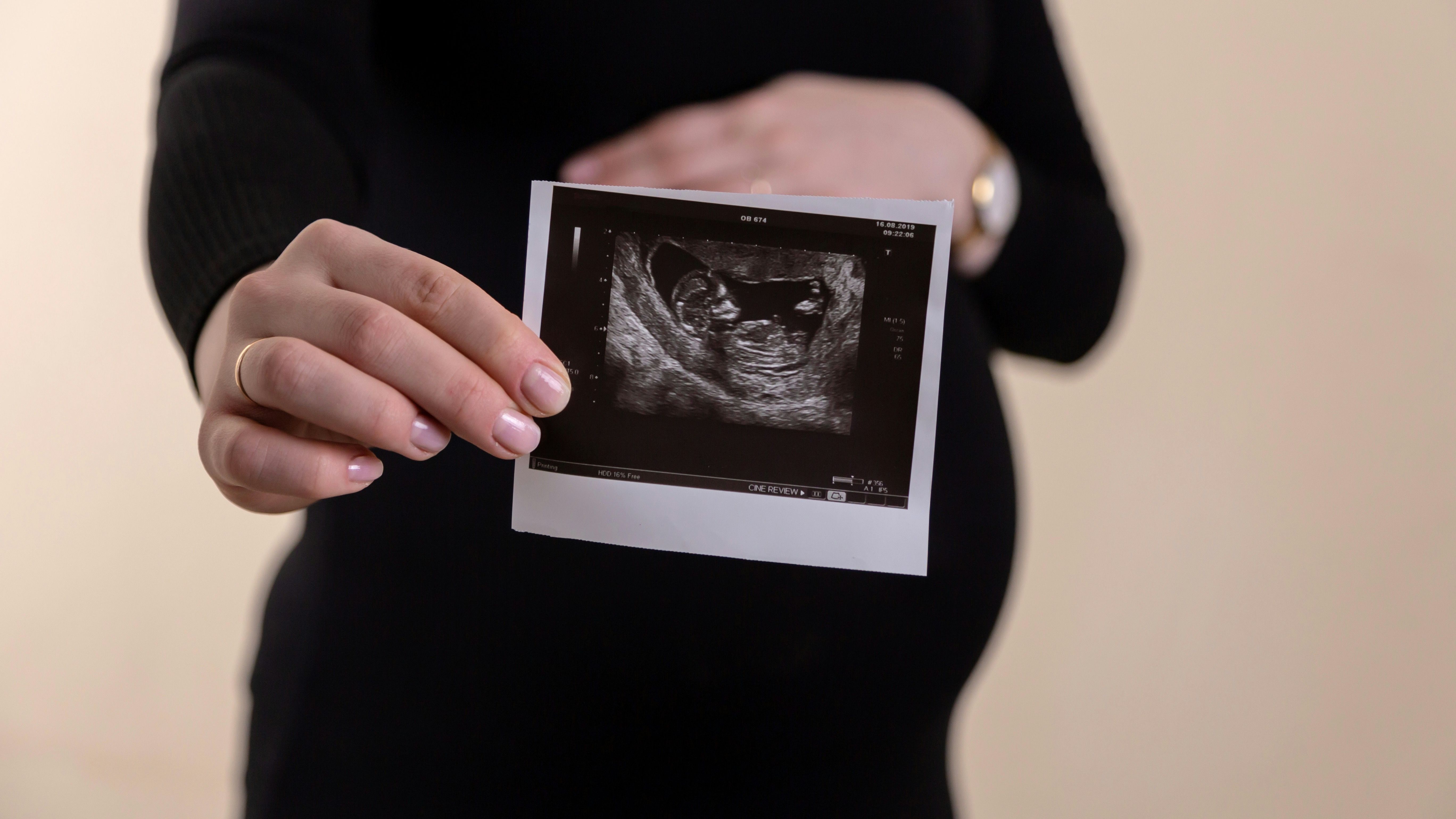 Hands holding an ultrasound image for prenatal care.